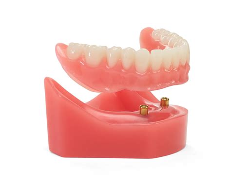 affordabledentures|Affordable Dentures Near You: Low